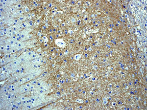 Immunohistochemistry (Formalin/PFA-fixed paraffin-embedded sections) - Anti-Somatostatin Receptor 2 antibody [UMB1] - BSA and Azide free (AB271907), expandable thumbnail