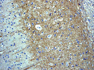 Immunohistochemistry (Formalin/PFA-fixed paraffin-embedded sections) - Anti-Somatostatin Receptor 2 antibody [UMB1] - BSA and Azide free (AB271907)