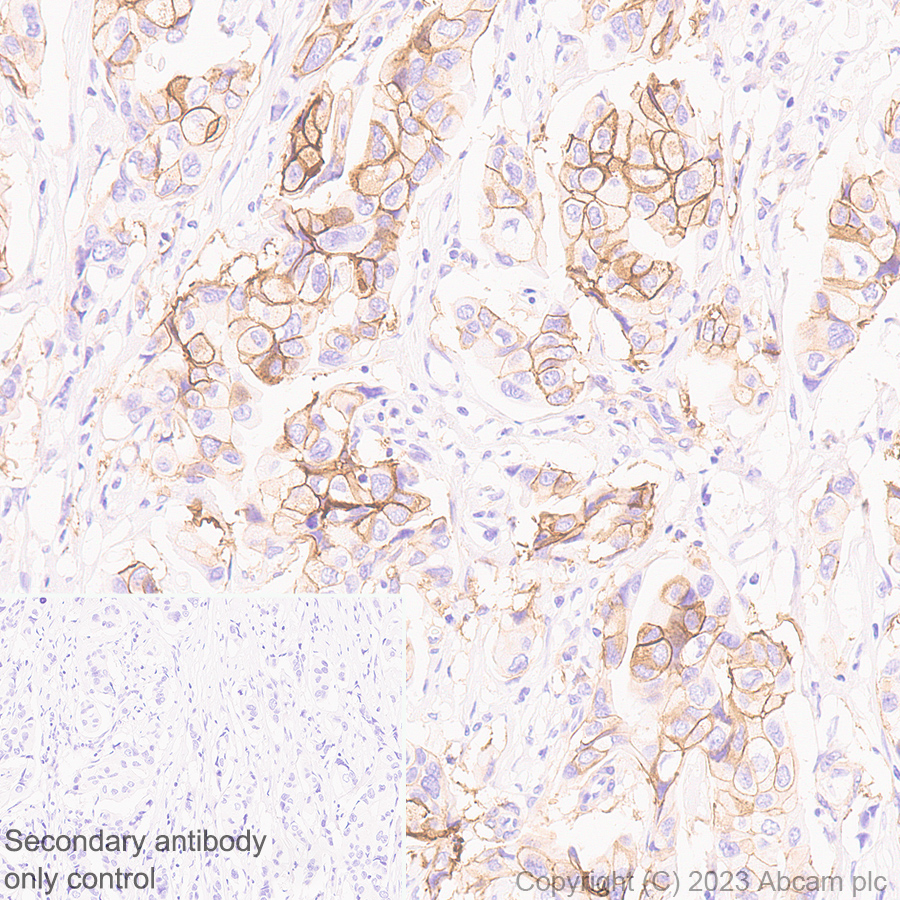 Immunohistochemistry (Formalin/PFA-fixed paraffin-embedded sections) - Anti-Somatostatin Receptor 2 antibody [UMB1] - BSA and Azide free (AB271907), expandable thumbnail