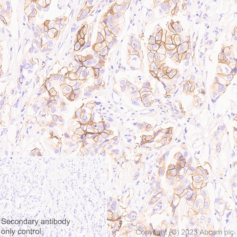 Immunohistochemistry (Formalin/PFA-fixed paraffin-embedded sections) - Anti-Somatostatin Receptor 2 antibody [UMB1] - BSA and Azide free (AB271907)