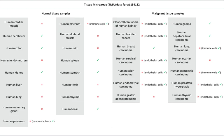 Immunohistochemistry (Formalin/PFA-fixed paraffin-embedded sections) - Anti-Somatostatin Receptor 2 antibody [UMB1] - BSA and Azide free (AB271907)