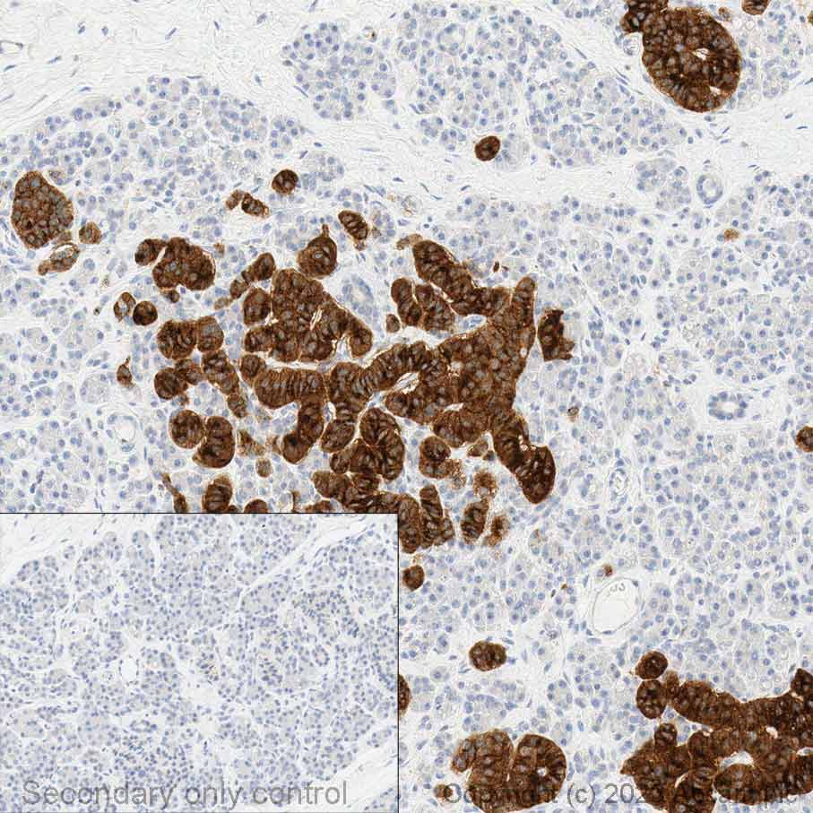 Immunohistochemistry (Formalin/PFA-fixed paraffin-embedded sections) - Anti-Somatostatin Receptor 2 antibody [UMB1] - BSA and Azide free (AB271907), expandable thumbnail