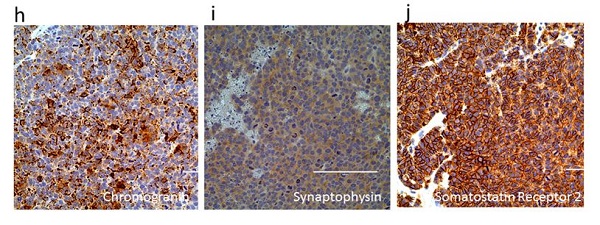 Immunohistochemistry (Formalin/PFA-fixed paraffin-embedded sections) - Anti-Somatostatin Receptor 2 antibody [UMB1] - C-terminal (AB134152), expandable thumbnail