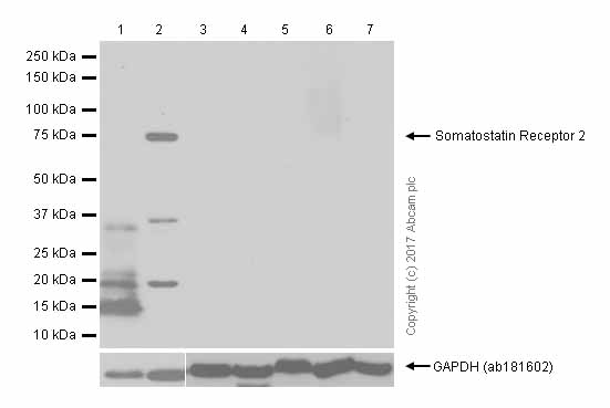 Western blot - Anti-Somatostatin Receptor 2 antibody [UMB1] - C-terminal (AB134152), expandable thumbnail