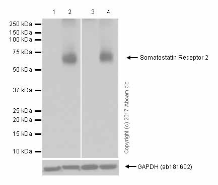 Western blot - Anti-Somatostatin Receptor 2 antibody [UMB1] - C-terminal (AB134152), expandable thumbnail