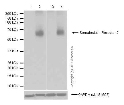 Western blot - Anti-Somatostatin Receptor 2 antibody [UMB1] - C-terminal (AB134152)