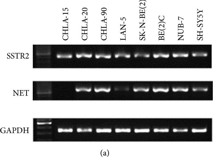 Western blot - Anti-Somatostatin Receptor 2 antibody [UMB1] - C-terminal (ab134152), expandable thumbnail