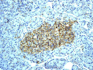 Immunohistochemistry (Formalin/PFA-fixed paraffin-embedded sections) - Anti-Somatostatin Receptor 2 antibody [UMB1] - Low endotoxin, Azide free (AB216649)