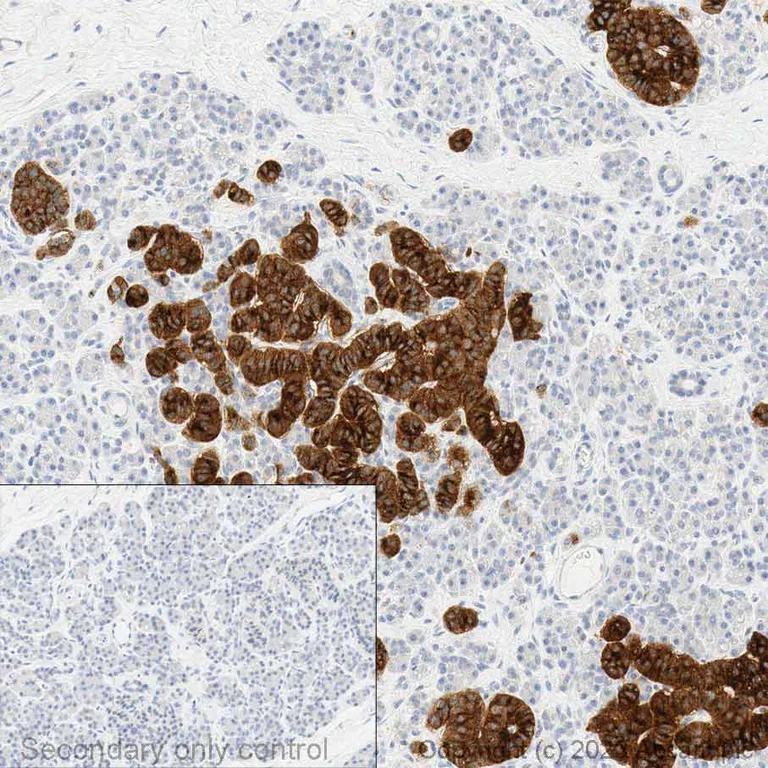 Immunohistochemistry (Formalin/PFA-fixed paraffin-embedded sections) - Anti-Somatostatin Receptor 2 antibody [UMB1] - Low endotoxin, Azide free (AB216649)