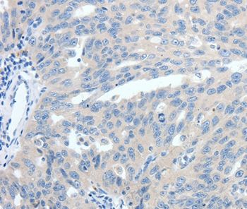 Immunohistochemistry (Formalin/PFA-fixed paraffin-embedded sections) - Anti-Somatostatin Receptor 3/SSTR3 antibody (AB198851)