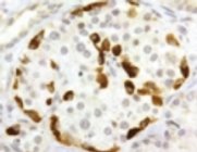 Immunohistochemistry (Formalin/PFA-fixed paraffin-embedded sections) - Anti-Somatostatin Receptor 3/SSTR3 antibody (AB28680)