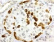 Immunohistochemistry (Formalin/PFA-fixed paraffin-embedded sections) - Anti-Somatostatin Receptor 3/SSTR3 antibody (AB28680)
