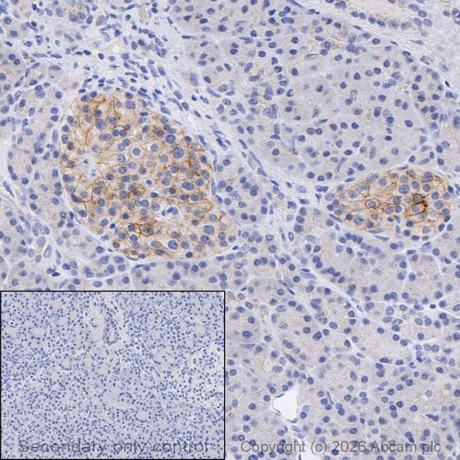 Immunohistochemistry (Formalin/PFA-fixed paraffin-embedded sections) - Anti-Somatostatin Receptor 5 antibody [UMB4] (AB109495)