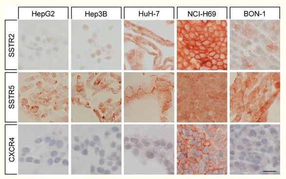 Immunohistochemistry (Formalin/PFA-fixed paraffin-embedded sections) - Anti-Somatostatin Receptor 5 antibody [UMB4] - BSA and Azide free (AB236074)