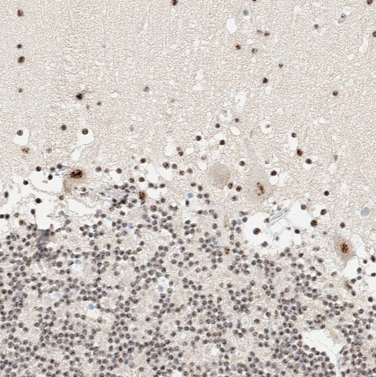 Immunohistochemistry (Formalin/PFA-fixed paraffin-embedded sections) - Anti-SON/DBP5 antibody (AB121759)