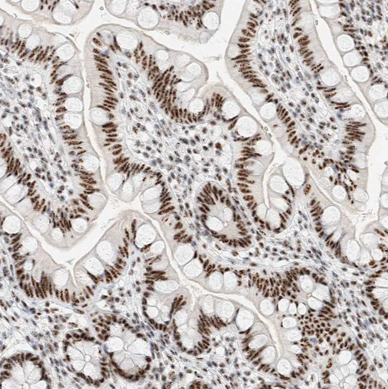Immunohistochemistry (Formalin/PFA-fixed paraffin-embedded sections) - Anti-SON/DBP5 antibody (AB121759)