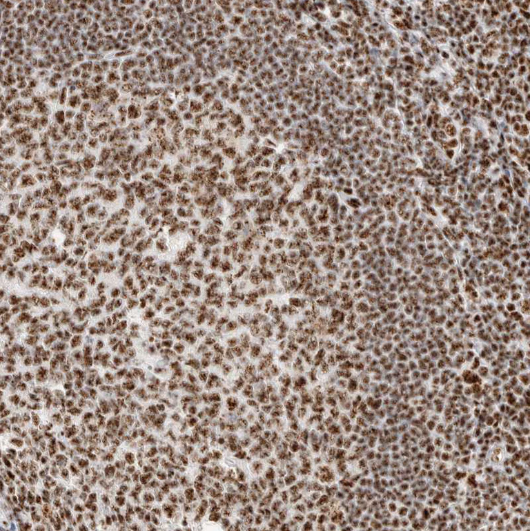 Immunohistochemistry (Formalin/PFA-fixed paraffin-embedded sections) - Anti-SON/DBP5 antibody (AB121759)