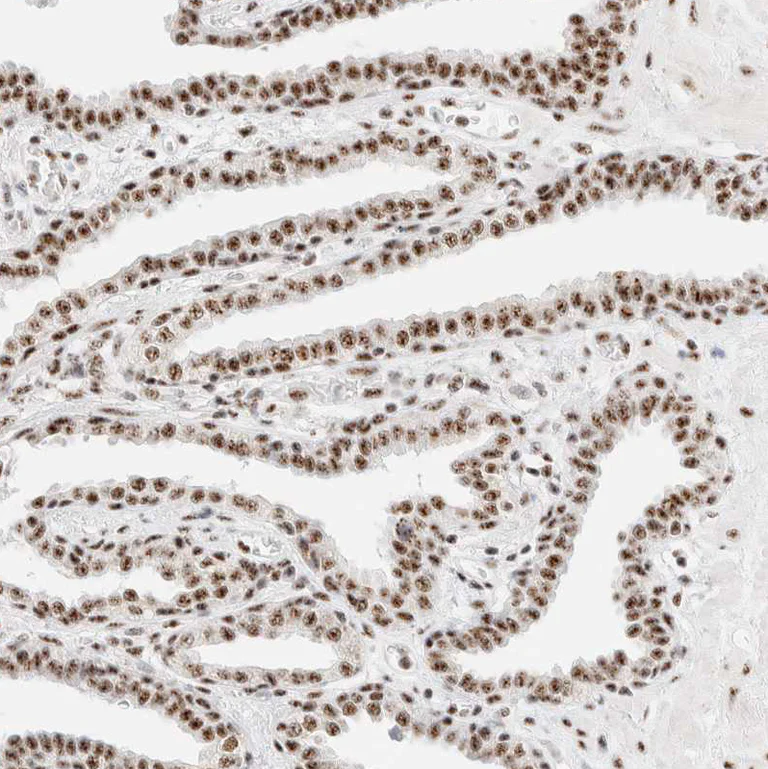 Immunohistochemistry (Formalin/PFA-fixed paraffin-embedded sections) - Anti-SON/DBP5 antibody (AB121759)