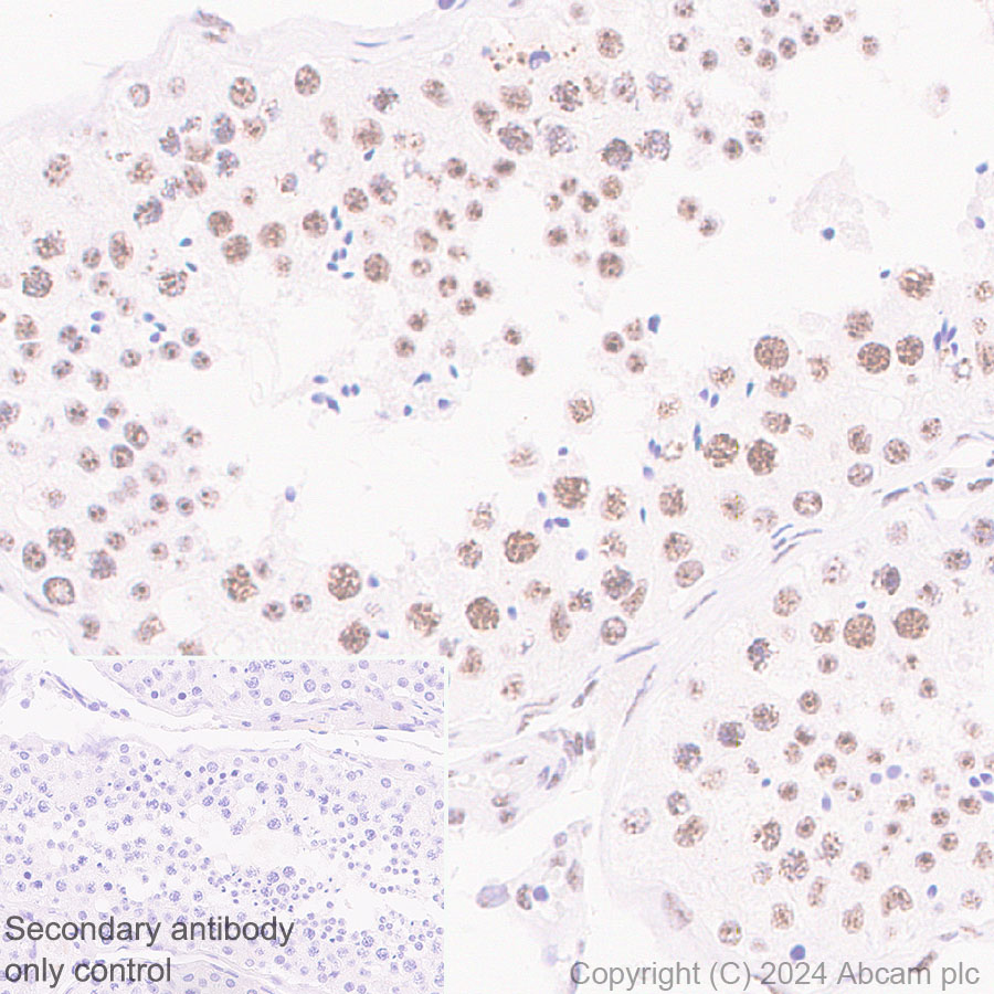 Immunohistochemistry (Formalin/PFA-fixed paraffin-embedded sections) - Anti-SON/DBP5 antibody [EPR28617-69] - BSA and Azide free (ab317312), expandable thumbnail
