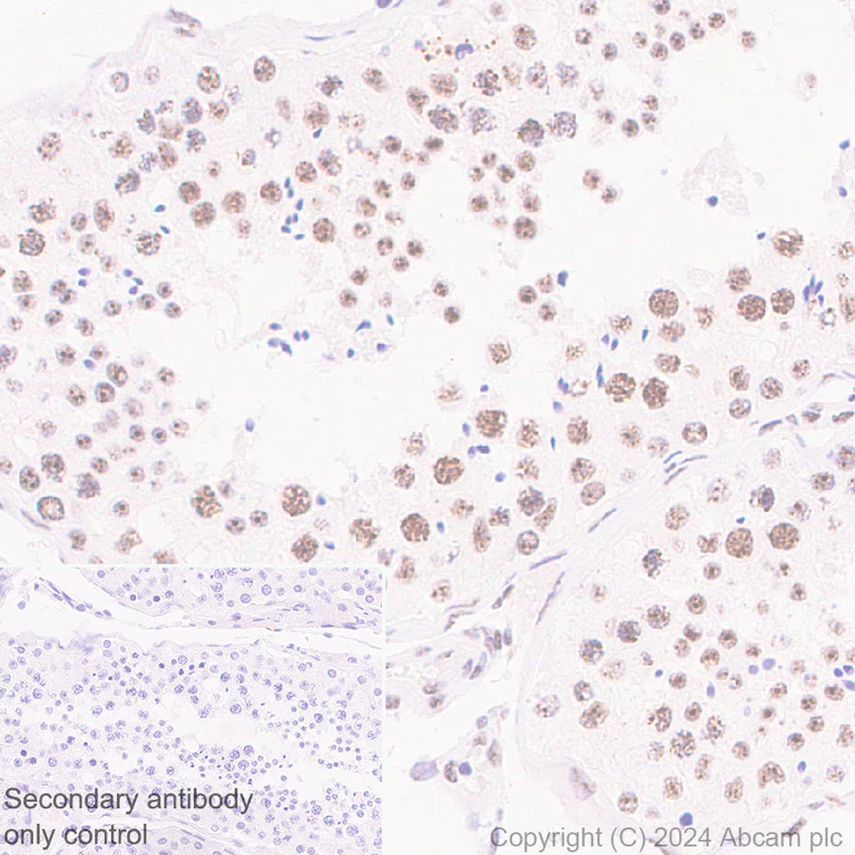 Immunohistochemistry (Formalin/PFA-fixed paraffin-embedded sections) - Anti-SON/DBP5 antibody [EPR28617-69] - BSA and Azide free (AB317312)