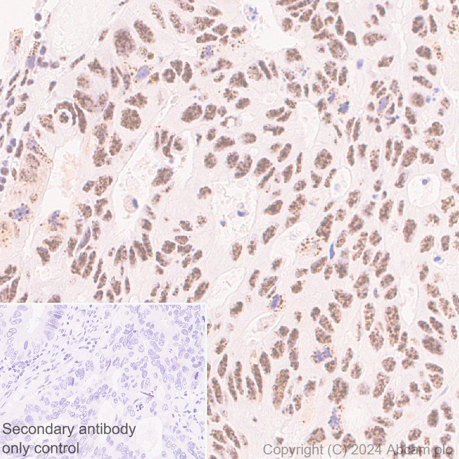Immunohistochemistry (Formalin/PFA-fixed paraffin-embedded sections) - Anti-SON/DBP5 antibody [EPR28617-69] - BSA and Azide free (AB317312), expandable thumbnail