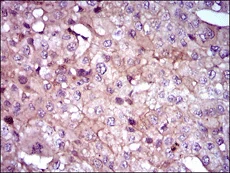 Immunohistochemistry (Formalin/PFA-fixed paraffin-embedded sections) - Anti-Sonic Hedgehog antibody [5H4] (AB135240)