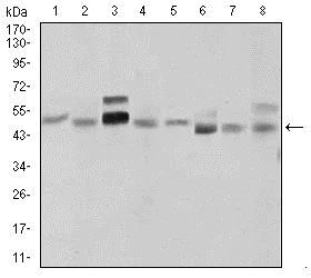Western blot - Anti-Sonic Hedgehog antibody [5H4] (AB135240)