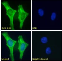 Immunocytochemistry/ Immunofluorescence - Anti-Sonic Hedgehog antibody (AB240438)