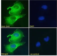 Immunocytochemistry/ Immunofluorescence - Anti-Sonic Hedgehog antibody (AB240438)