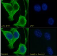 Immunocytochemistry/ Immunofluorescence - Anti-Sonic Hedgehog antibody (AB240438), expandable thumbnail