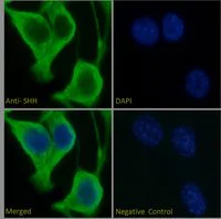 Immunocytochemistry/ Immunofluorescence - Anti-Sonic Hedgehog antibody (AB240438)