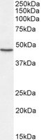 Western blot - Anti-Sonic Hedgehog antibody (AB240438), expandable thumbnail