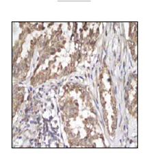 Immunohistochemistry (Formalin/PFA-fixed paraffin-embedded sections) - Anti-Sonic Hedgehog antibody [EP1190Y] (AB53281)