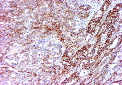 Immunohistochemistry (Formalin/PFA-fixed paraffin-embedded sections) - Anti-Sonic Hedgehog antibody [EP1190Y] (AB53281)