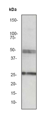 Western blot - Anti-Sonic Hedgehog antibody [EP1190Y] (ab53281), expandable thumbnail