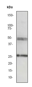 Western blot - Anti-Sonic Hedgehog antibody [EP1190Y] (AB53281)