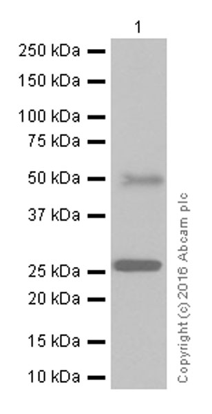 Western blot - Anti-Sonic Hedgehog antibody [EP1190Y] (AB53281), expandable thumbnail