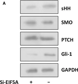 Western blot - Anti-Sonic Hedgehog antibody [EP1190Y] (AB53281)