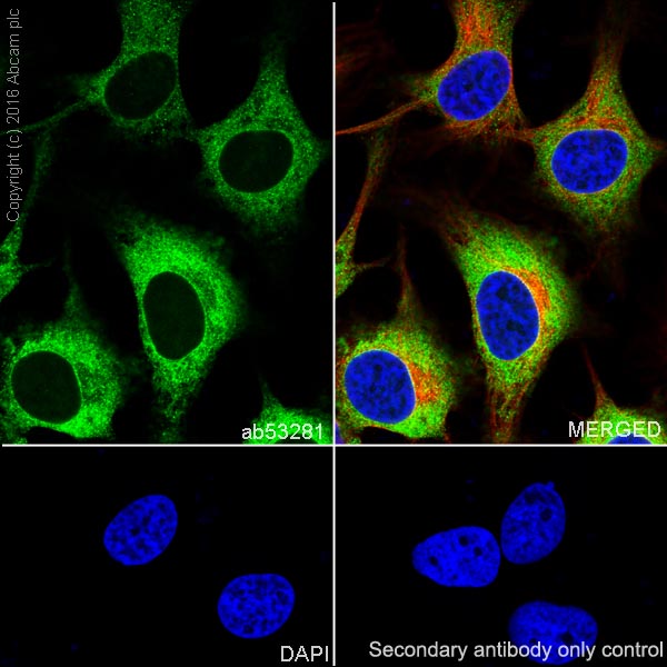Immunocytochemistry/ Immunofluorescence - Anti-Sonic Hedgehog antibody [EP1190Y] - BSA and Azide free (AB175180), expandable thumbnail