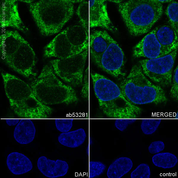 Immunocytochemistry/ Immunofluorescence - Anti-Sonic Hedgehog antibody [EP1190Y] - BSA and Azide free (AB175180)