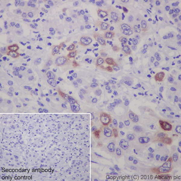 Immunohistochemistry (Formalin/PFA-fixed paraffin-embedded sections) - Anti-Sonic Hedgehog antibody [EP1190Y] - BSA and Azide free (AB175180), expandable thumbnail