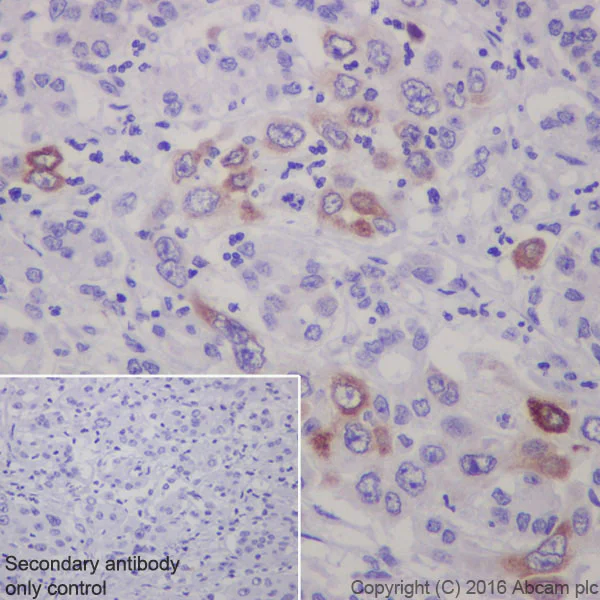 Immunohistochemistry (Formalin/PFA-fixed paraffin-embedded sections) - Anti-Sonic Hedgehog antibody [EP1190Y] - BSA and Azide free (AB175180)