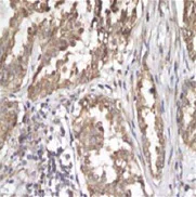 Immunohistochemistry (Formalin/PFA-fixed paraffin-embedded sections) - Anti-Sonic Hedgehog antibody [EP1190Y] - BSA and Azide free (AB175180)