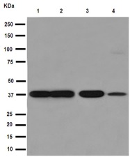 Western blot - Anti-Sorbitol Dehydrogenase antibody [EPR15857] - BSA and Azide free (AB250982), expandable thumbnail