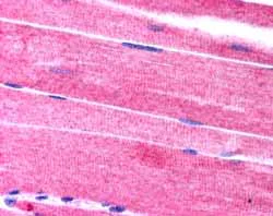 Immunohistochemistry (Formalin/PFA-fixed paraffin-embedded sections) - Anti-SORBS1 antibody (AB4551)