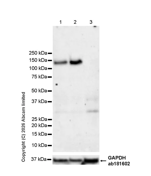 Western blot - Anti-SorCS1 antibody [EPR30536-522] (AB325598)