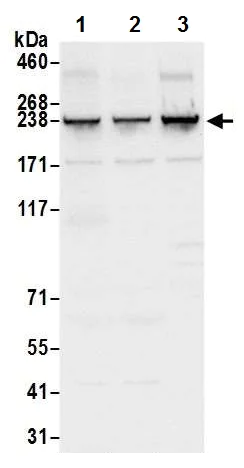 Western blot - Anti-SorLA/SORL1 antibody - C-terminal (AB226339)