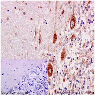 Immunohistochemistry (Formalin/PFA-fixed paraffin-embedded sections) - Anti-SorLA/SORL1 antibody [EPR14670] (AB190684), expandable thumbnail