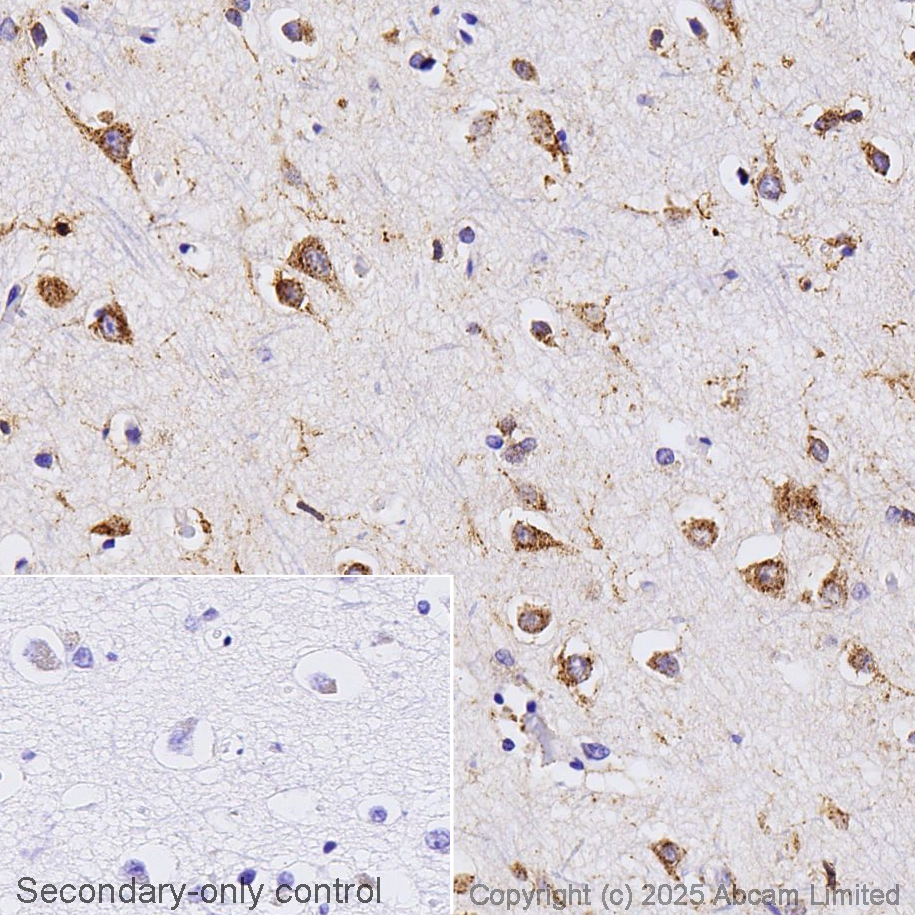 Immunohistochemistry (Formalin/PFA-fixed paraffin-embedded sections) - Anti-SorLA/SORL1 antibody [EPR14670] (AB190684)