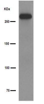 Western blot - Anti-SorLA/SORL1 antibody [EPR14670] (AB190684), expandable thumbnail